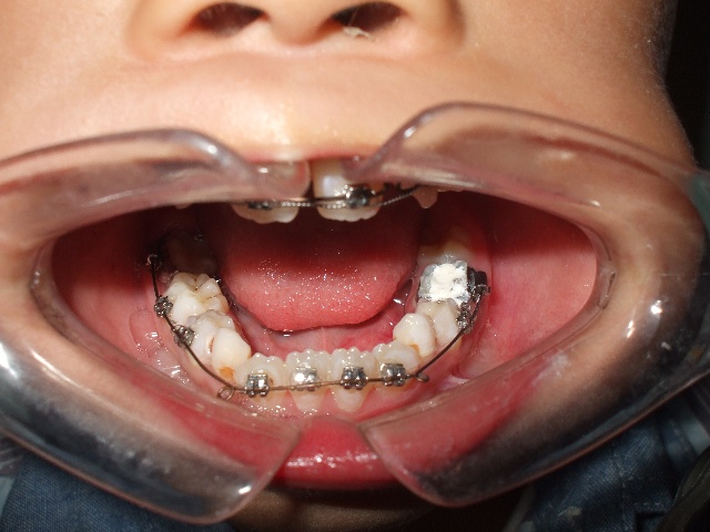 IM电竞:玉泽演与51K签订专属合约 组合2PM活动仍属于JYP(图1) IM电竞平台